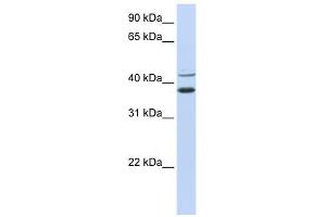 MKRN2 antibody used at 1 ug/ml to detect target protein. (MKRN2 antibody  (N-Term))