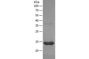 CD34 Protein (CD34) (AA 124-225) (His tag)