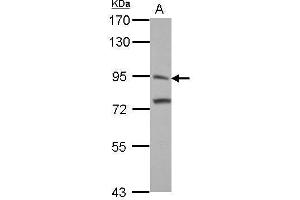 Western Blotting (WB) image for anti-Inter alpha Globulin Inhibitor H3 (ITIH3) antibody (ABIN2856866)