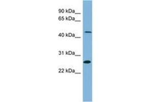 Image no. 1 for anti-Ureidopropionase, beta (UPB1) (AA 287-336) antibody (ABIN6743103) (UPB1 antibody  (AA 287-336))