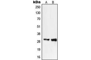 Western blot analysis of PIGX expression in COLO205 (A), WI38 (B) whole cell lysates.