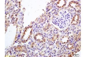 Formalin-fixed and paraffin embedded rat kidney labeled with Anti-DMT1/Dematin Polyclonal Antibody, Unconjugated (ABIN701065) at 1:200 followed by conjugation to the secondary antibody and DAB staining. (SLC11A2 antibody  (AA 251-350))