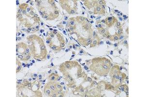 Immunohistochemistry of paraffin-embedded Human stomach using ST8SIA2 Polyclonal Antibody at dilution of 1:100 (40x lens).