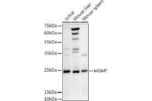 Western blot analysis of extracts of various cell lines, using MGMT antibody (ABIN3021096, ABIN3021097, ABIN3021098 and ABIN6213949) at 1:1000 dilution.