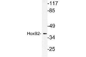 Western blot (WB) analysis of HoxB2 antibody in extracts from LOVO cells. (HOXB2 antibody)