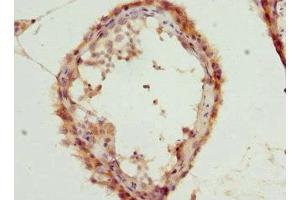 Immunohistochemistry of paraffin-embedded human testis tissue using ABIN7153465 at dilution of 1:100 (LGALS8 antibody  (AA 20-317))