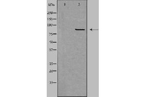 Western blot analysis of extracts from HepG2 cells using CPT1B antibody.