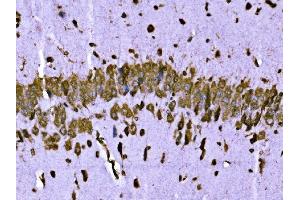 IHC analysis of BRSK1 using anti-BRSK1 antibody (ABIN7600990). (BRSK1 antibody  (AA 269-321))