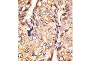 Image no. 2 for anti-Growth Differentiation Factor 10 (GDF10) (N-Term) antibody (ABIN357454) (GDF10 antibody  (N-Term))