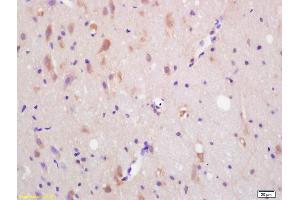 Formalin-fixed and paraffin embedded rat brain labeled with Anti-CXCR7/RDC1 Polyclonal Antibody, Unconjugated (ABIN1387536) at 1:200 followed by conjugation to the secondary antibody and DAB staining.