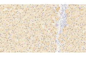Detection of LMTK3 in Human Liver Tissue using Polyclonal Antibody to Lemur Tyrosine Kinase 3 (LMTK3) (LMTK3 antibody  (AA 133-411))