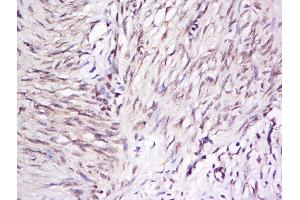 Formalin-fixed and paraffin embedded rat brain labeled with Anti-OTUD5 Polyclonal Antibody, Unconjugated  at 1:500 followed by conjugation to the secondary antibody and DAB staining. (OTUD5 antibody  (AA 501-571))