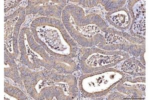 IHC analysis of MT-CO2 using anti-MT-CO2 antibody (ABIN7599081).