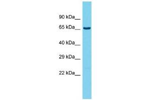 Host: Rabbit  Target Name: Ubash3b  Sample Tissue: Rat Testis lysates  Antibody Dilution: 1. (UBASH3B antibody  (C-Term))