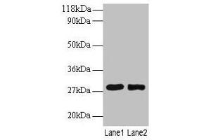 Western blot All lanes: MPZ antibody at 2 μg/mL Lane 1: 293T whole cell lysate Lane 2: EC109 whole cell lysate Secondary Goat polyclonal to rabbit IgG at 1/15000 dilution Predicted band size: 28, 35 kDa Observed band size: 28 kDa (MPZ antibody  (AA 30-156))