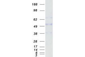 Western Blotting (WB) image for Fucosidase, alpha-L- 1, Tissue (FUCA1) protein (Myc-DYKDDDDK Tag) (ABIN2714633)