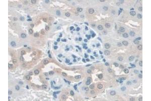 DAB staining on IHC-P; Samples: Mouse Kidney Tissue (SCAF11 antibody  (AA 969-1165))