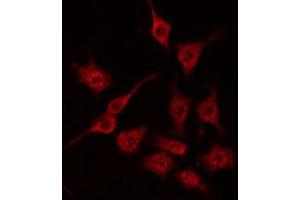ABIN6272244 staining HeLa by IF/ICC. (ARHGAP1 antibody  (Internal Region))