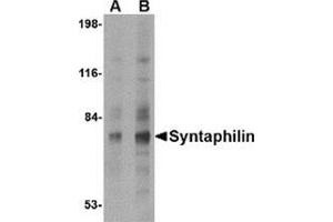 Western blot analysis of Syntaphilin in human brain tissue lysate with this product at (A) 2 and (B) 4 μg/ml. (Syntaphilin antibody  (N-Term))