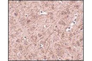 Immunohistochemistry of LASS6 in mouse brain tissue with this product at 2. (CERS6 antibody  (N-Term))