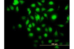 Immunofluorescence of monoclonal antibody to BAG1 on HeLa cell. (BAG1 antibody  (AA 241-345))