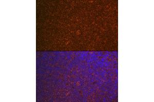 Immunofluorescence (IF) image for anti-Caspase Recruitment Domain Family, Member 11 (CARD11) antibody (ABIN7266125)