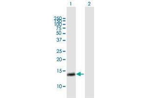 Western Blot analysis of RAB28 expression in transfected 293T cell line by RAB28 MaxPab polyclonal antibody. (RAB28 antibody  (AA 1-95))
