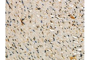 Phospho-SNAIL (Ser11) Antibody at 1/100 staining Rat heart tissue by IHC-P.
