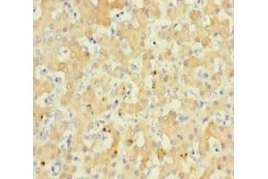 Immunohistochemistry of paraffin-embedded human liver tissue using ABIN7167868 at dilution of 1:100 (RS1 antibody  (AA 24-224))