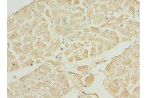 IHC analysis of paraffin-embedded human heart tissue using TNNI3K antibody (1/100 dilution). (TNNI3K antibody  (AA 1-75))