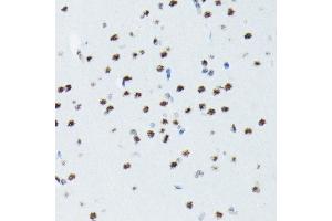 Immunohistochemistry of paraffin-embedded rat brain using Phospho-p70 S6 Kinase 1-T421/S424 antibody (ABIN6135340, ABIN6136296, ABIN6136297 and ABIN7101878) at dilution of 1:100 (40x lens). (RPS6KB1 antibody  (pSer424, pThr421))