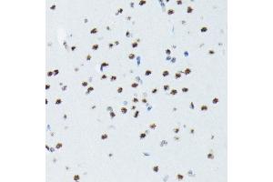 Immunohistochemistry of paraffin-embedded rat brain using Phospho-p70 S6 Kinase 1-T421/S424 antibody (ABIN6135340, ABIN6136296, ABIN6136297 and ABIN7101878) at dilution of 1:100 (40x lens). (RPS6KB1 antibody  (pSer424, pThr421))