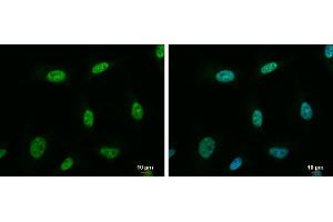 ICC/IF Image NRF1 antibody detects NRF1 protein at nucleus by immunofluorescent analysis. (NRF1 antibody)