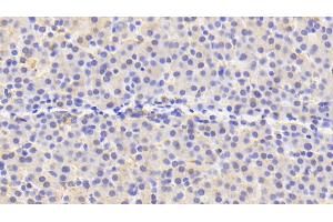 Detection of PRDX4 in Human Liver Tissue using Polyclonal Antibody to Peroxiredoxin 4 (PRDX4) (Peroxiredoxin 4 antibody  (AA 6-249))