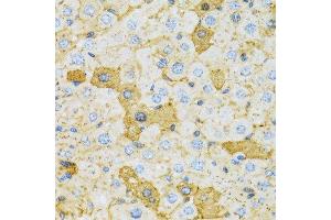 Immunohistochemistry of paraffin-embedded rat liver using OXA1L antibody. (OXA1L antibody  (AA 396-495))