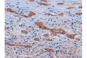 Immunohistochemistry (IHC) image for anti-Intercellular Adhesion Molecule 1 (ICAM1) (AA 41-464) antibody (ABIN7431971)