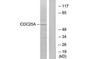 Western blot analysis of extracts from A2780 cells, treated with UV, using CDC25A (Ab-75) Antibody. (CDC25A antibody  (AA 43-92))