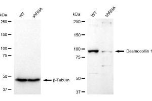 Western blotting analysis using Desmocollin 1 antibody (ABIN7798315). (Recombinant Desmocollin 1 antibody)