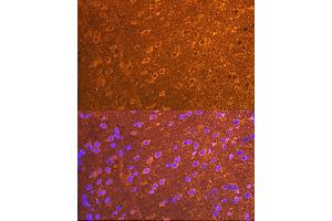 Immunofluorescence analysis of mouse brain cells using PSD93/chapsyn-110/DLG2 Rabbit mAb (ABIN7266793) at dilution of 1:100 (40x lens). (DLG2 antibody)