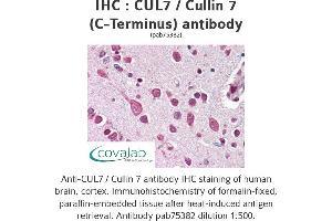 Image no. 1 for anti-Cullin 7 (CUL7) antibody (ABIN1733382) (Cullin 7 antibody)