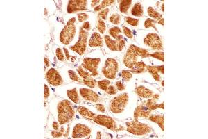 Antibody staining PCCA in human heart tissue sections by Immunohistochemistry (IHC-P - paraformaldehyde-fixed, paraffin-embedded sections).