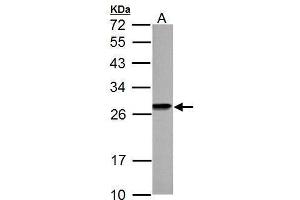 Western Blotting (WB) image for anti-High Mobility Group Box 1 (HMGB1) antibody (ABIN2854997)
