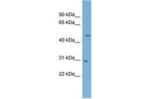 Image no. 1 for anti-NADH Dehydrogenase (Ubiquinone) Fe-S Protein 3, 30kDa (NADH-Coenzyme Q Reductase) (NDUFS3) (AA 179-228) antibody (ABIN6744092) (NDUFS3 antibody  (AA 179-228))