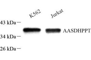 Western blot analysis of AASD-PPT (ABIN7073034) at dilution of 1: 500 (AASDHPPT antibody)