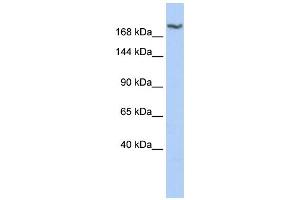 WB Suggested Anti-DSCAM Antibody Titration: 0. (DSCAM antibody  (Middle Region))