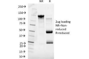 SDS-PAGE Analysis Purified SHBG Mouse Monoclonal Antibody (SHBG/245). (SHBG antibody)