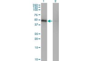 Western Blot analysis of ZNF24 expression in transfected 293T cell line by ZNF24 monoclonal antibody (M03), clone 4C2. (ZNF24 antibody  (AA 1-368))