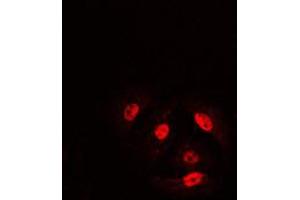 Immunofluorescent analysis of Cofilin (pS3) staining in HeLa cells. (Cofilin antibody  (N-Term, pSer3))