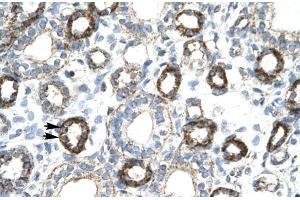 Human kidney; FOXF2 antibody - N-terminal region in Human kidney cells using Immunohistochemistry