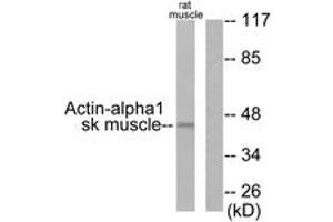 Western blot analysis of extracts from rat muscle cells, using Actin-alpha-1 Antibody. (Actin antibody  (AA 1-50))